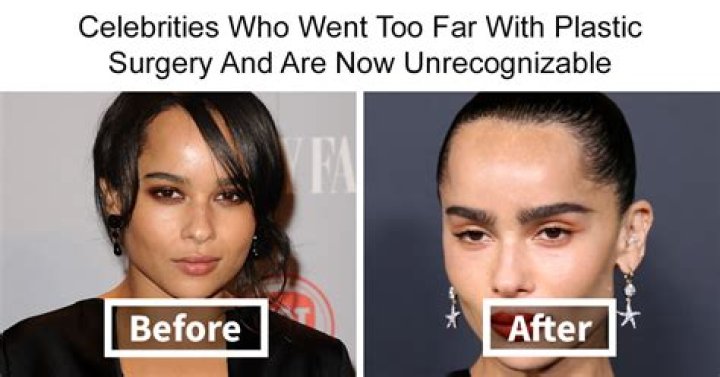 A Journey Before Plastic Surgery