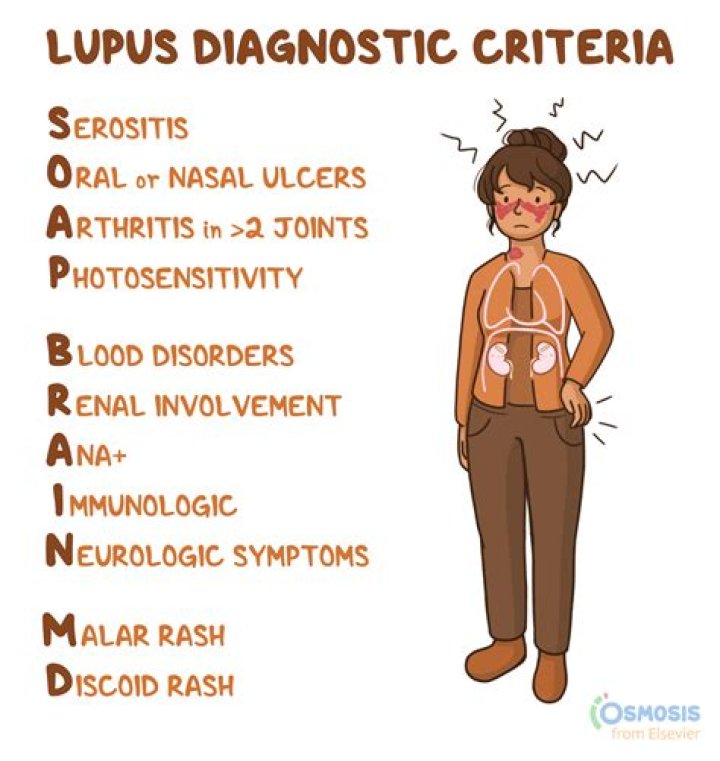 A Potential Treatment For Lupus That's Changing Lives