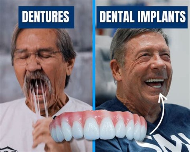 Ben Affleck's Dentures: A Hollywood Tale Of Smiles And Struggles
