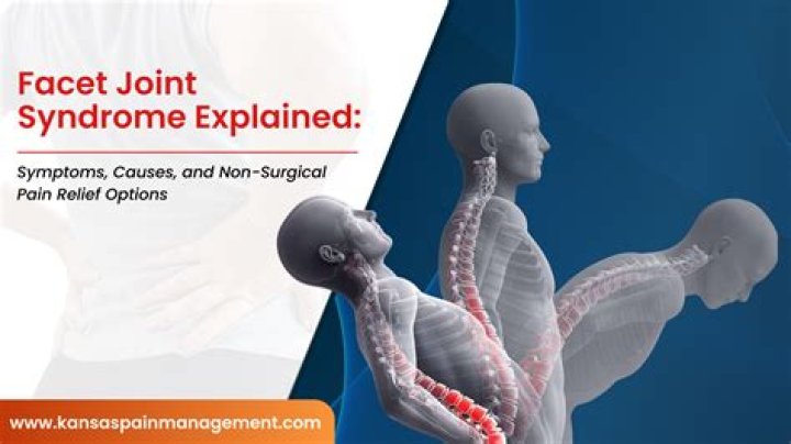 Discover Facet Hypertrophy: Causes, Symptoms, And Treatment Options