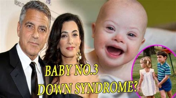Exploring Down Syndrome And George Clooney's Twins
