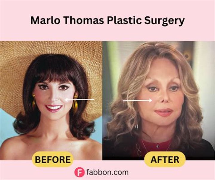 Get The Scoop: Marlo Thomas Surgery Details Revealed