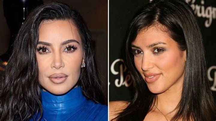 Kim Kardashian's Plastic Surgery Journey: Before And After Transformation