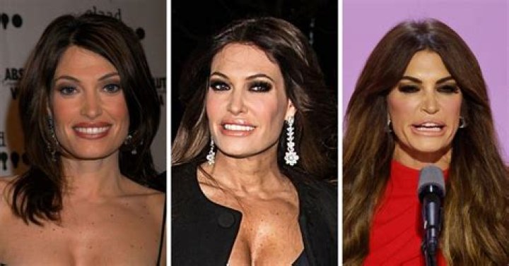 Kimberly Guilfoyle Cosmetic Surgery: Uncovering The Transformation