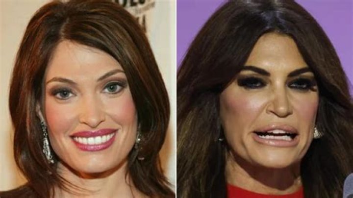 Kimberly Guilfoyle Face: Uncovering Her Unique Features