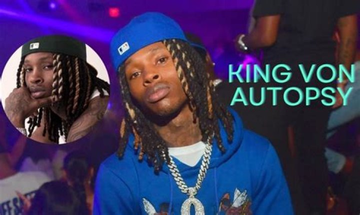 King Von's Autopsy Image Unveiled