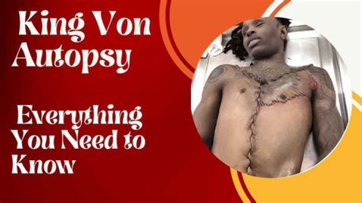 King Von Autopsy Photos Revealed
