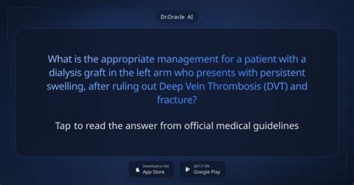 Ruling Out Deep Vein Thrombosis