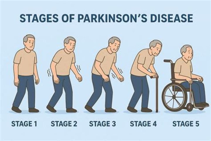 Shedding Light On Parkinson's Speculations