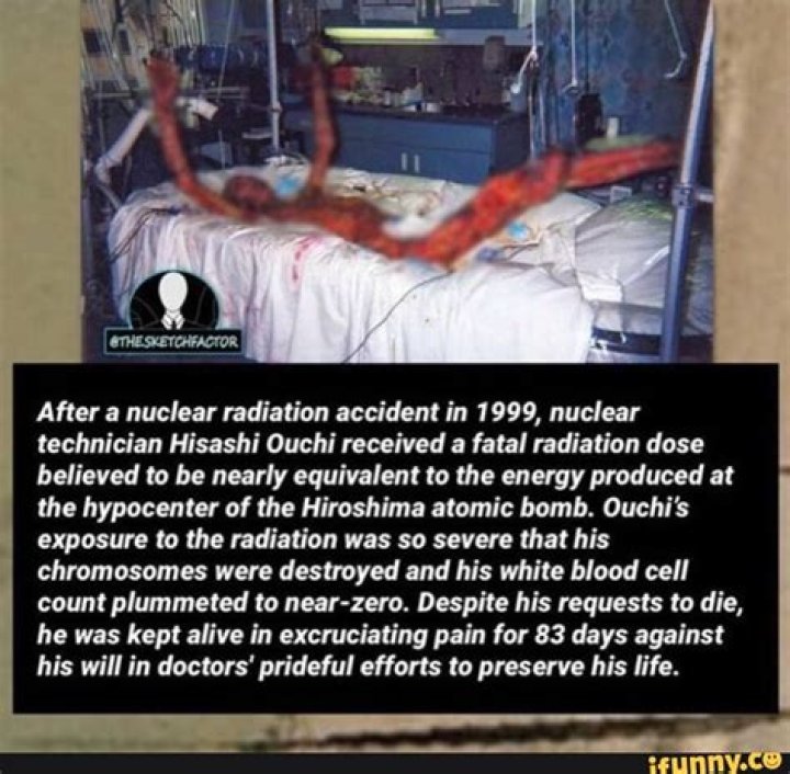 The Harrowing True Story Of Hisashi Ouchi: A Tragic Radiation Incident