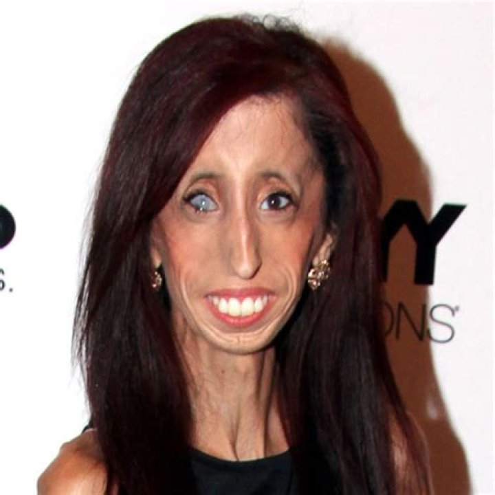 The Surprising Truth About Being Dubbed The Ugliest Person In The World