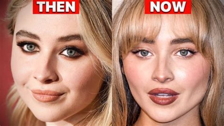 The Truth About Sabrina Carpenter's Plastic Surgery Transformation