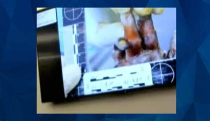 Unveiling The Gannon Stauch Autopsy Photos Leak: Uncovering Truths And Ethical Implications