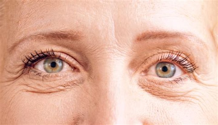 Unveiling The Secrets: Actors With Droopy Eye